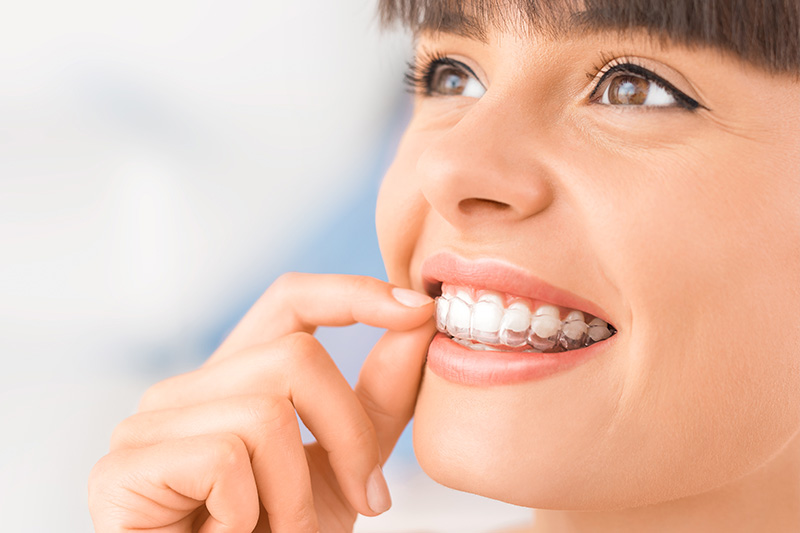 Invisalign in Norcross, Stockbridge & Lithia Springs