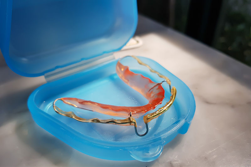 Retainers in Norcross, Stockbridge & Lithia Springs