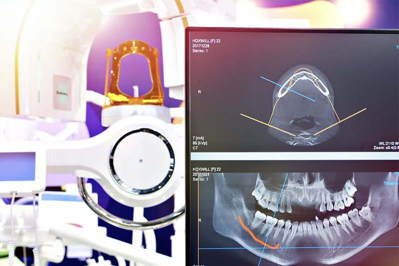 Digital X-Rays in Norcross, Stockbridge & Lithia Springs